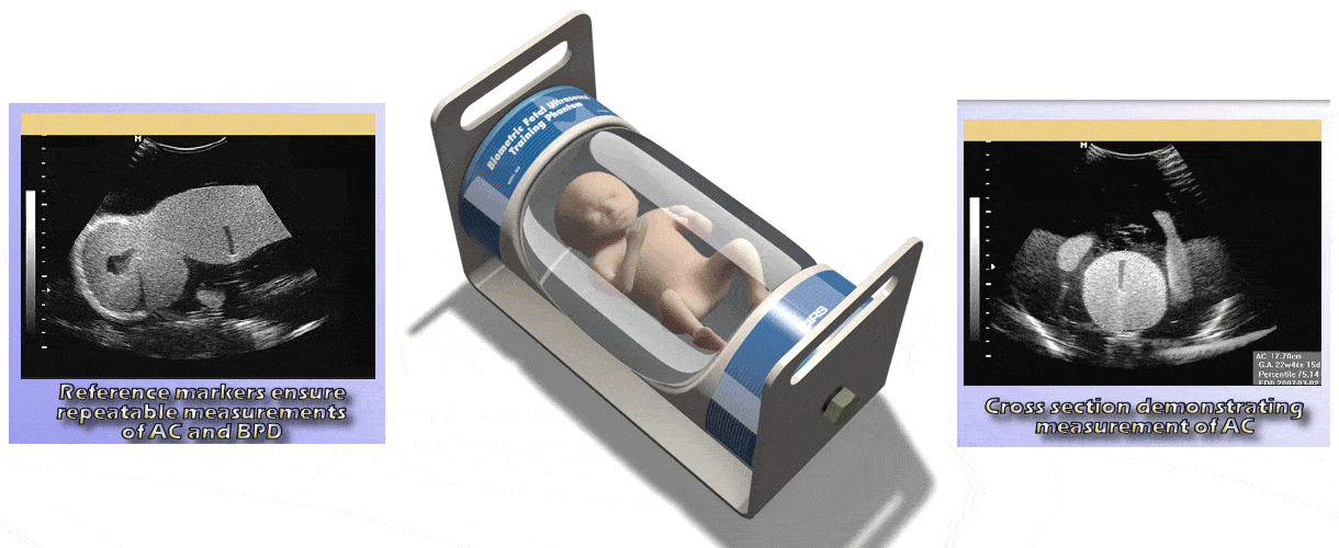 Mẫu chuẩn sinh trắc siêu âm bào thai Model 068